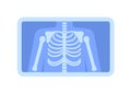Flat style geometric x-ray of human chest bones. Royalty Free Stock Photo