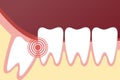 Flat toothache and dental problems concept