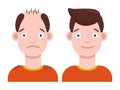 Flat vector illustration: man with bald head and man with thick hair. Hair transplant concept. Hair loss concept