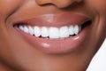 Flawless Bright Smile. Close-Up of African American Womans Perfect White Teeth After Dental Visit
