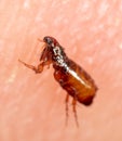 Flea on human skin Royalty Free Stock Photo