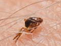 Flea Siphonaptera on human skin Royalty Free Stock Photo