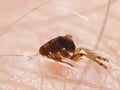 Flea Siphonaptera on human skin Royalty Free Stock Photo