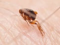 Flea Siphonaptera on human skin Royalty Free Stock Photo