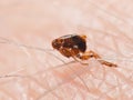 Flea Siphonaptera on human skin Royalty Free Stock Photo