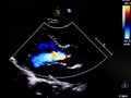 Flow color mode in echocardiogram