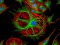 Fluorescence Microscope image of human cells undergoing mitosis