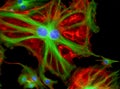 Fluorescence Microscope image of cells undergoing mitosis Royalty Free Stock Photo