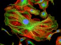 Fluorescence Microscope image of human cells undergoing mitosis Royalty Free Stock Photo