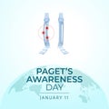 Flyers honoring Paget's Awareness Day