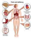 Folic acid defiency 3d medical illustration infographic