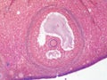 Follicle and egg cell in human ovary under microscope