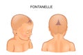 Fontanel in the infant