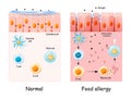 Food allergy. development of an allergic reaction