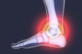 Foot and ankle pain, 3D illustration
