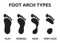 Foot arch types