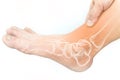 Foot bones injury Royalty Free Stock Photo