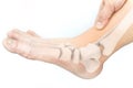 Foot bones injury Royalty Free Stock Photo