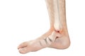 Foot bones pain Royalty Free Stock Photo