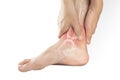 Foot bones pain Royalty Free Stock Photo