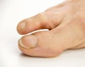 Foot with calluses Royalty Free Stock Photo