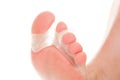 Foot close up with silicone separator Royalty Free Stock Photo