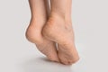 Foot with dry skin on heel and sole. women female feet with rough cracked skin isolated on gray background, close up, copyspace Royalty Free Stock Photo