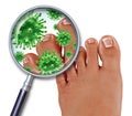 Foot Fungus Royalty Free Stock Photo