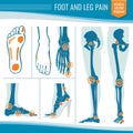 Foot and leg pain. Arthritis and rheumatism orthopedic medical vector diagram