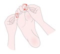 Foot massage. Bunion. Hallux valgus or bunion formation of the foot. Female hands massage the foot. Kneading and prevention of