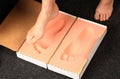 Foot measurement for orthotics