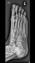 Foot medical xray, lower limb bones