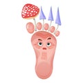 Foot nail fungus vector cartoon illustration. Parasitic mushrooms on leg. Fungal infection skin of feet, mycosis toenail.