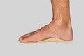 Foot on orthotics or orthopedic insole to support arch of flat feet on white background