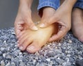 Foot pain, Asian woman standing feeling pain in her foot, female suffering from feet Royalty Free Stock Photo