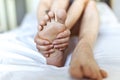 Foot Pain woman sitting on the bed holding her feet at home having painful feet and stretching muscles fatigue To relieve pain. Royalty Free Stock Photo