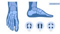 Foot pathologies poster