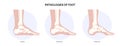 Foot pathologies poster