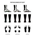 Foot pathologies poster