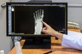 Doctor pointing on the foot problem point on x-ray film. x-ray film show skeleton knee on film. Surgery medical technology concept