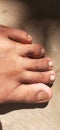 foot skin desease in adult men in asia