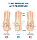 Foot supination and pronation vector illustration. Labeled medical scheme.