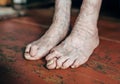 Foot which have bunion hallux valgus problem on floor Royalty Free Stock Photo