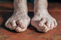 Foot which have bunion hallux valgus problem on floor Royalty Free Stock Photo