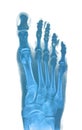 Foot x-ray