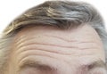 Forehead men wrinkles, gray