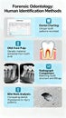 Forensic Odontology Human Identification Methods with Dental Charting and Analysis Royalty Free Stock Photo