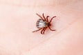 Forest mite on the skin. wood tick Royalty Free Stock Photo