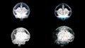 Four brains spinning with mri scanning on black background, health concept. Animation. Human brain, right and left