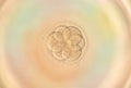 Four cell human embryonic development under microscopy Royalty Free Stock Photo